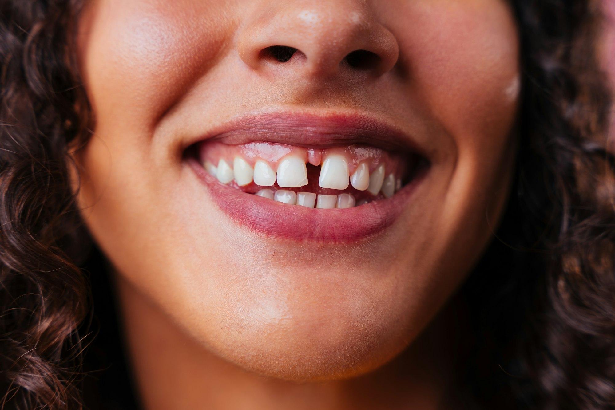 Creative studio portrait of beautiful hispanic woman with diastema